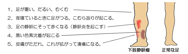 kashi_jyoumyakuryu